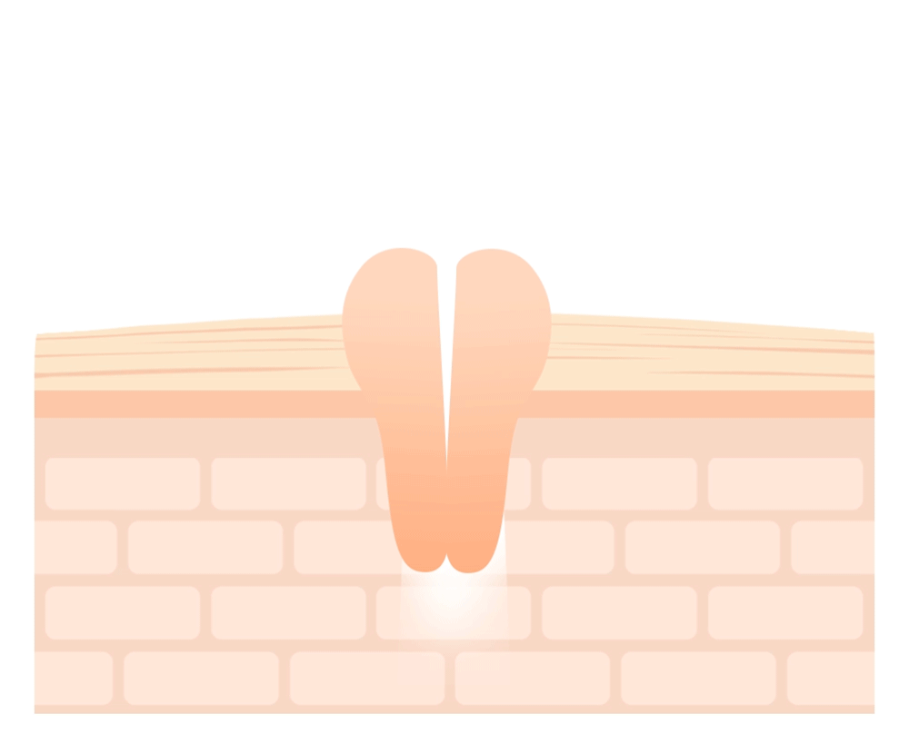 [Needly] Crossbarrier Mask 30 sheets - NURVA