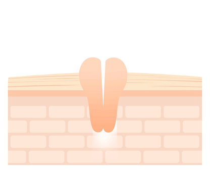 [Needly] Crossbarrier Mask 30 sheets - NURVA